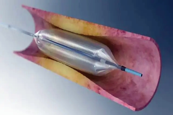 球囊導(dǎo)管密封性測(cè)試儀和應(yīng)用方法是什么？